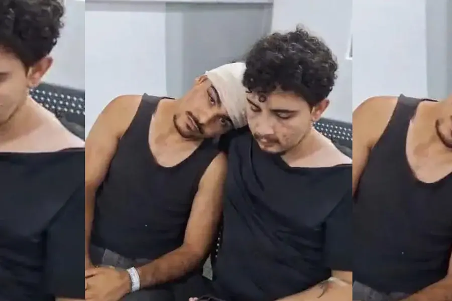 Casal gay é agredido com pedradas na zona oeste de São Paulo e caso pode ser investigado como homofobia