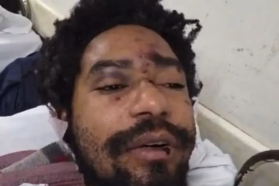 Ator é internado após sofrer ataque homofóbico em adega no centro de São Paulo